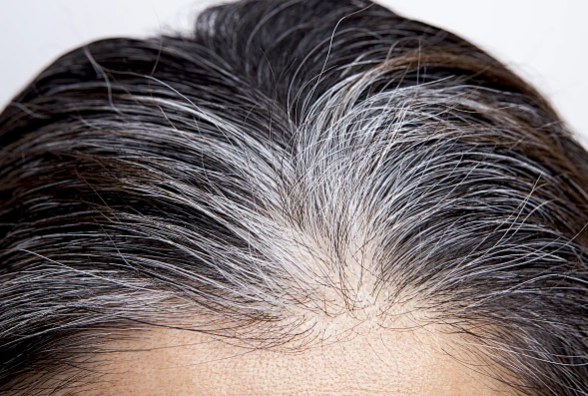 医学视角:皮肤科医生解读——为何说“唯秦秘头皮抗衰”是科学,而不仅是概念?