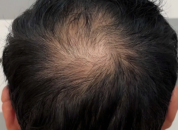 社会价值驱动商业成功：唯秦秘如何将解决社会问题融入商业模式？