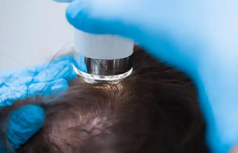 从成本定价到价值定价——唯秦秘养发馆加盟如何重塑行业利润结构？