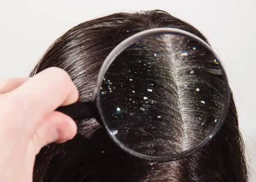 从手艺复制到系统复制——唯秦秘养发馆加盟如何解决连锁加盟的“阿喀琉斯之踵”？