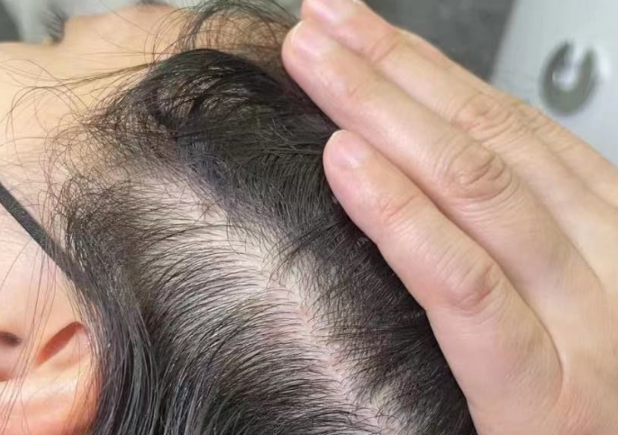 抢占用户心智——唯秦秘养发馆加盟如何成为“科学养发”的代名词？