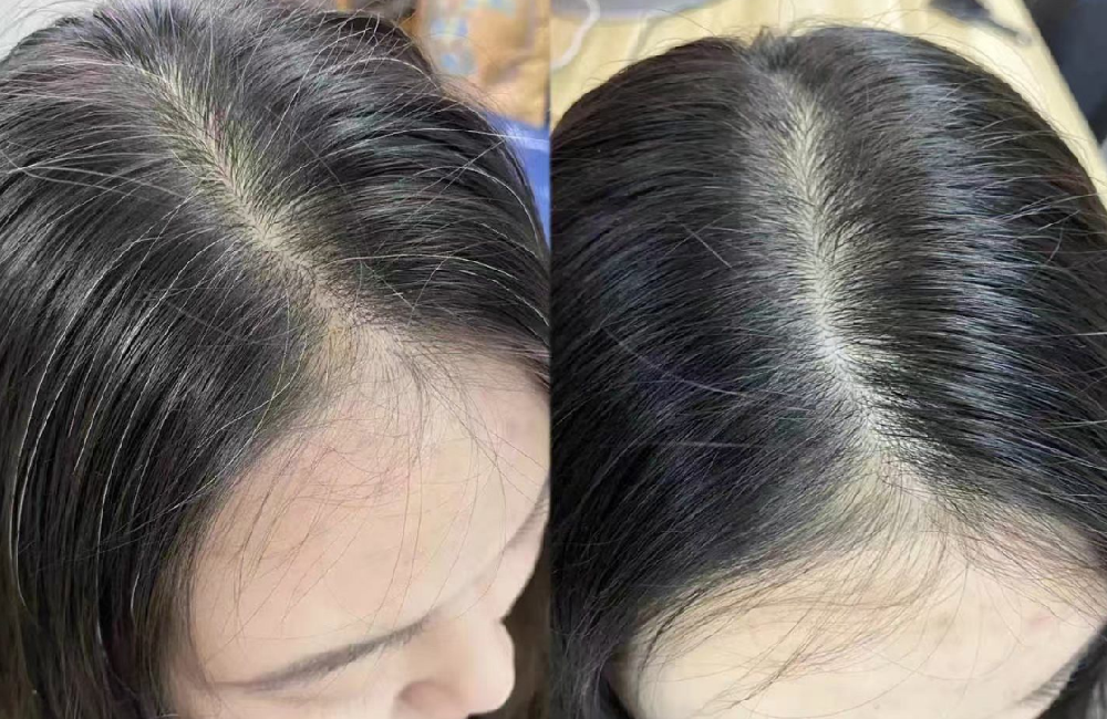 重塑体验链条——唯秦秘养发馆加盟如何让每一步都超出预期？