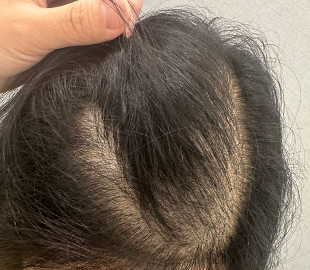 剖析唯秦秘养发馆加盟“高客单”背后的“低决策成本”逻辑