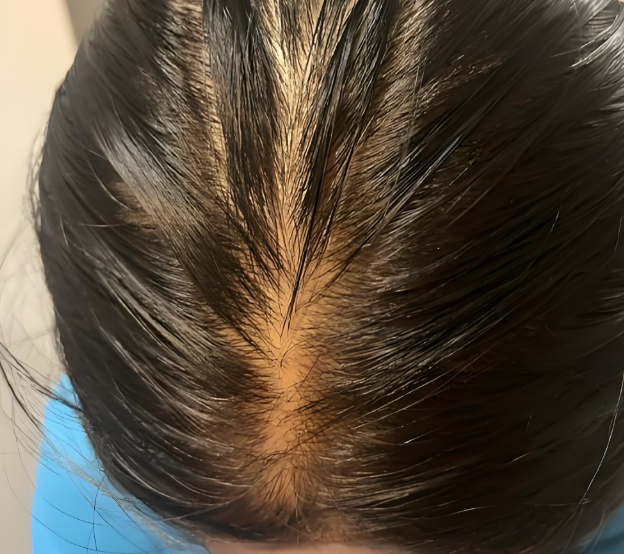 唯秦秘养发馆加盟的“反脆弱”系统设计如何在不确定性中获益？