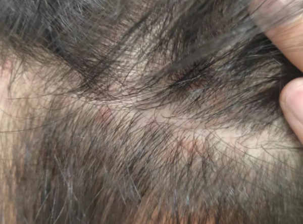 当健康消费从“治病”转向“防病”：唯秦秘如何抓住新一代的选择