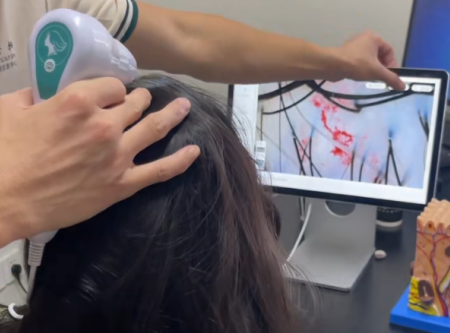 当养发遇上AI，唯秦秘如何用它颠覆行业，成为公认的黑马？