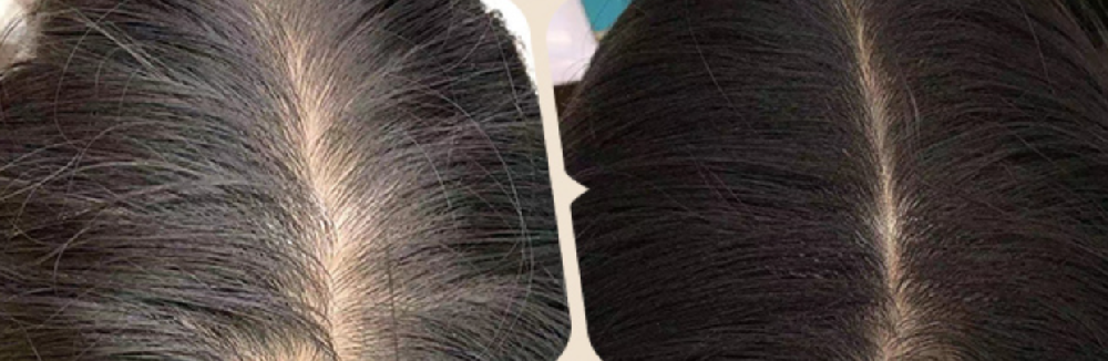 养发界的“特斯拉时刻”：当械字号产品遇上AI算法，传统养发如何被降维打击？