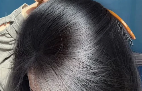 从“治脱发”到“管头皮”：唯秦秘养发馆加盟如何开拓10倍大的新市场？