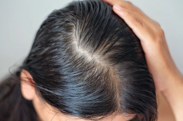 为什么经济波动下，唯秦秘的“头皮健康管理”需求反而更稳定？