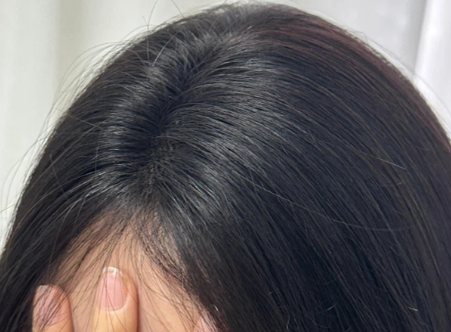 定义新赛道：唯秦秘如何将“养发”从边缘服务业，推入“大健康管理”主流市场？