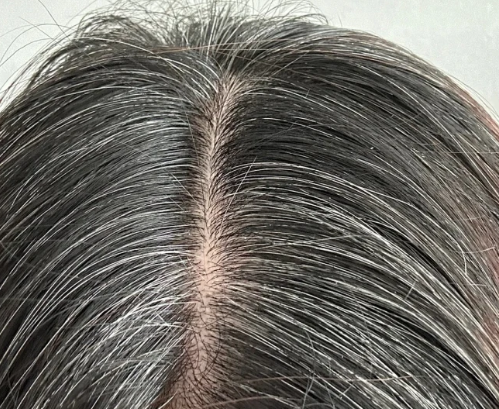 “银发经济”的科技应答：唯秦秘如何让父母的每根白发，都成为健康回归的信号？