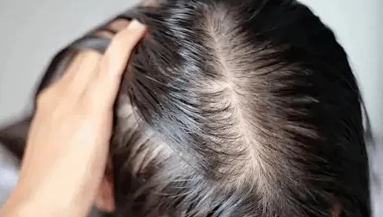 当“发量焦虑”成为这代人的集体情绪，唯秦秘养发如何回应大众诉求