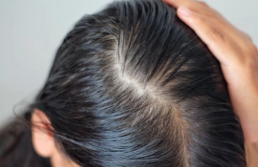 养发行业沉迷营销概念，唯秦秘如何用“一人一方案”重新定义养发服务